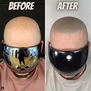 hair tattoo after