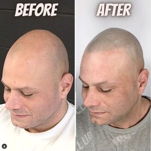 smp transformation