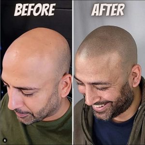 transformation hair tattoo